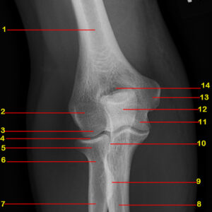 Radiological Anatomy Notes(All Topics)